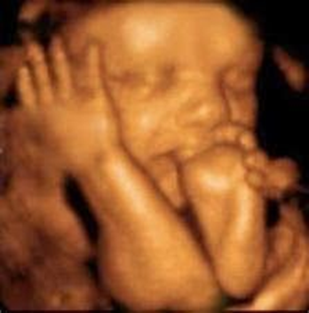 TIMT 3D/ 4D Obstetrical Services